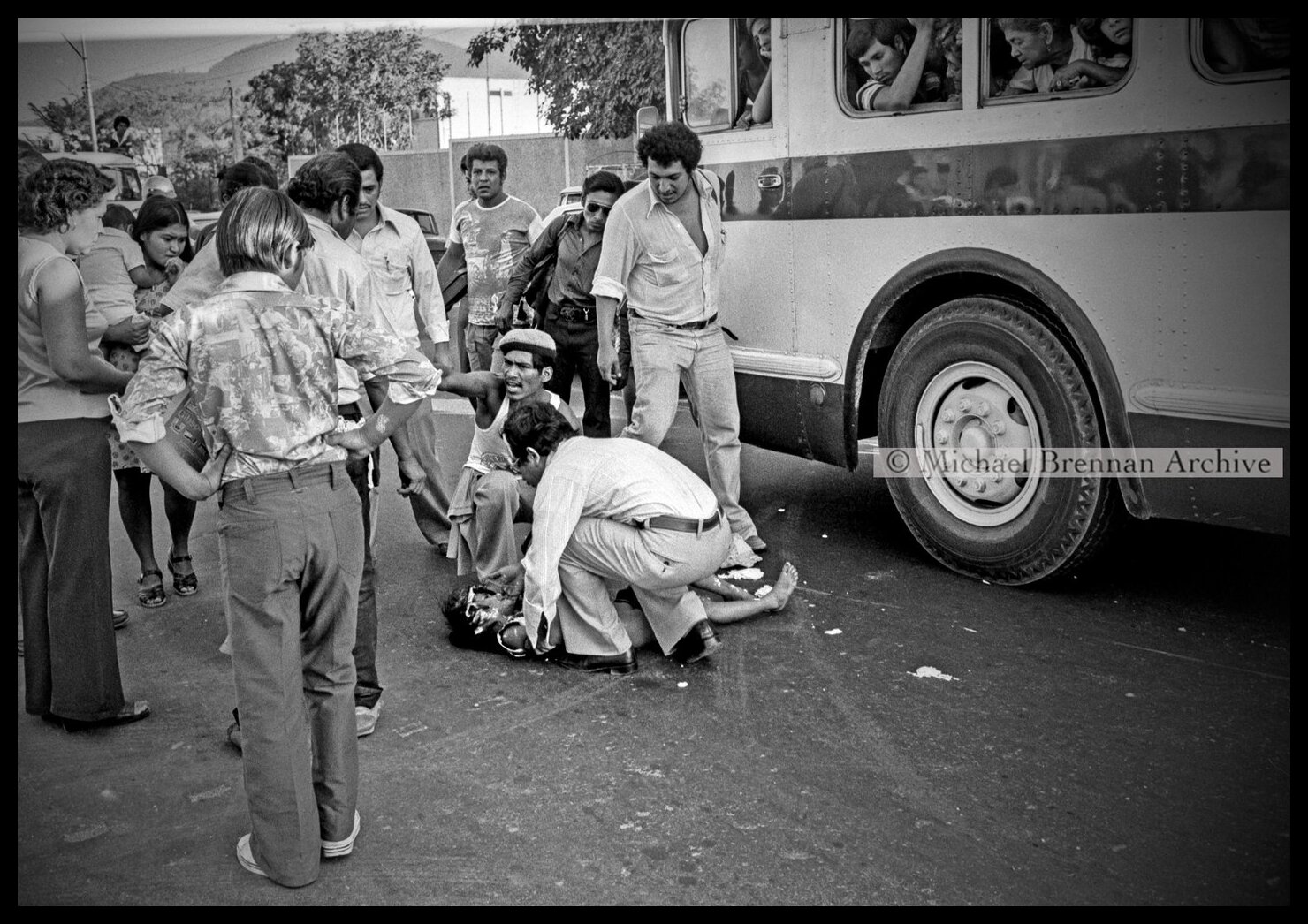 Child Hit by Bus — San Salvador, El Salvador · 1980